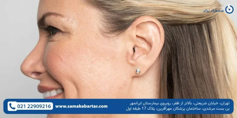 سمعک نامرئی: خرید، قیمت، بهترین و جدیدترین سمعک نامرئی