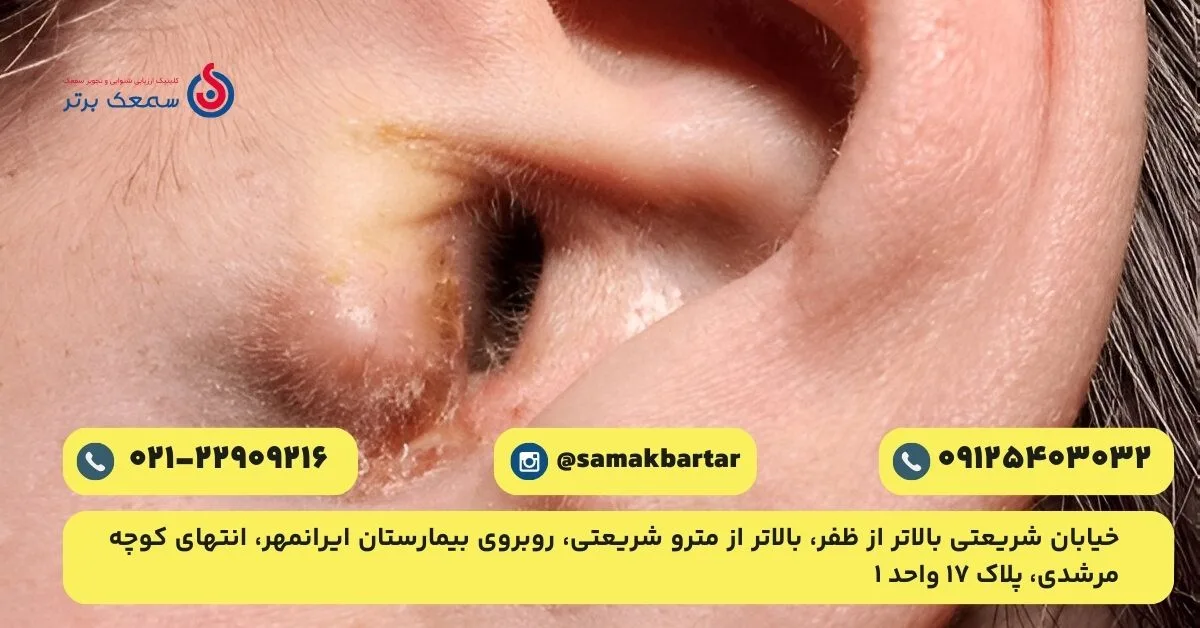 عکس قارچ گوش