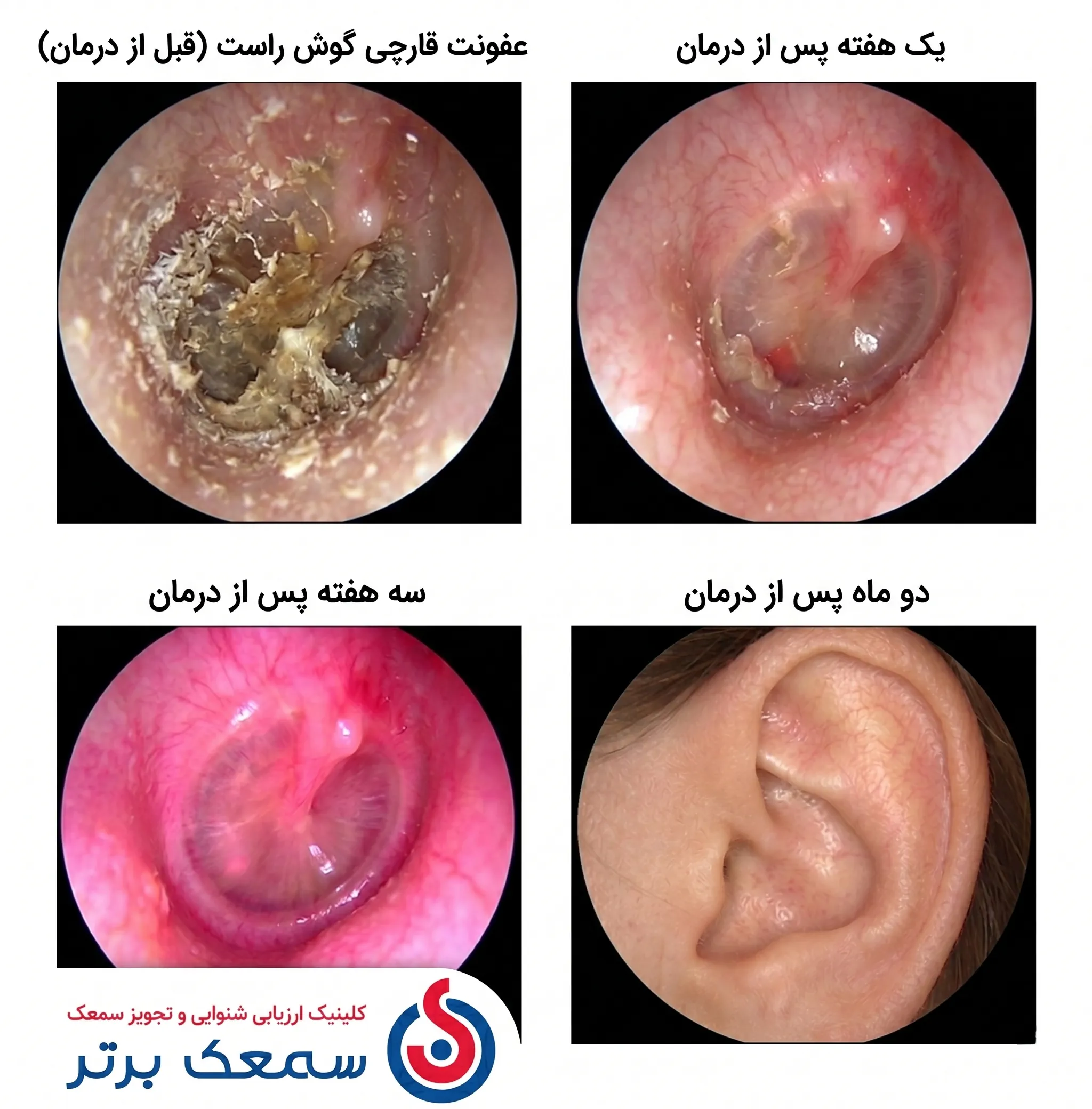 مراحل قارچ گوش  - عکس قارچ گوش