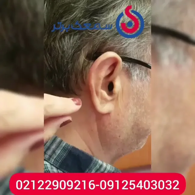 سمعک IIC دفتر ارزیابی شنوایی سمعک برتر سمعک IIC