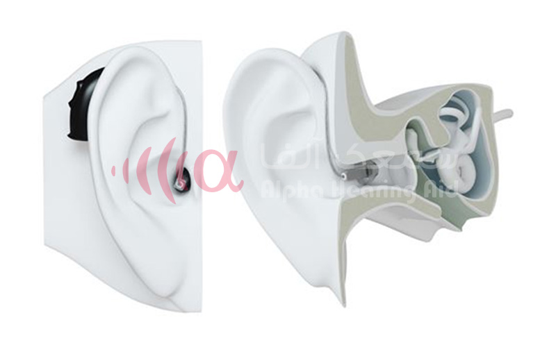 سمعک هوشمند 3 سمعک با گیرنده داخل گوش RIE