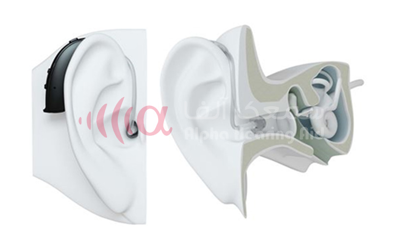 سمعک هوشمند 4 سمعک با گیرنده در پشت گوش BTE