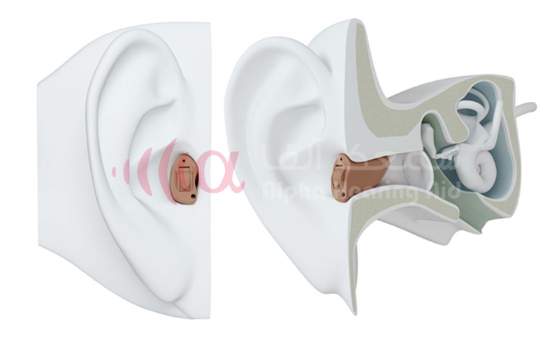 سمعک هوشمند کاملا داخل کانال CIC سمعک هوشمند کاملا داخل کانال CIC