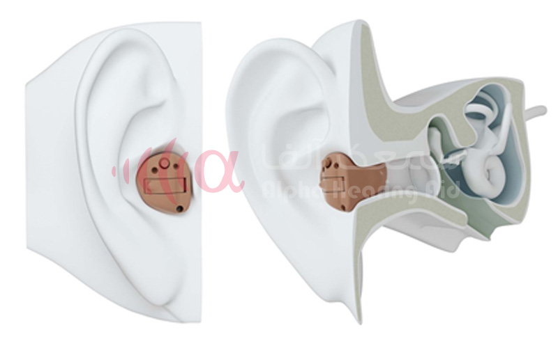 سمعک هوشمند داخل کانال ITC سمعک هوشمند داخل کانال ITC