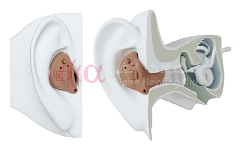 سمعک هوشمند داخل گوش ITE سمعک هوشمند داخل گوش ITE